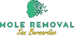 Mole Removal San Bernardino Logo