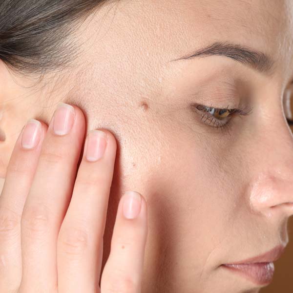 Mole Removal Rancho Cucamonga