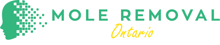 Mole Removal Ontario logo