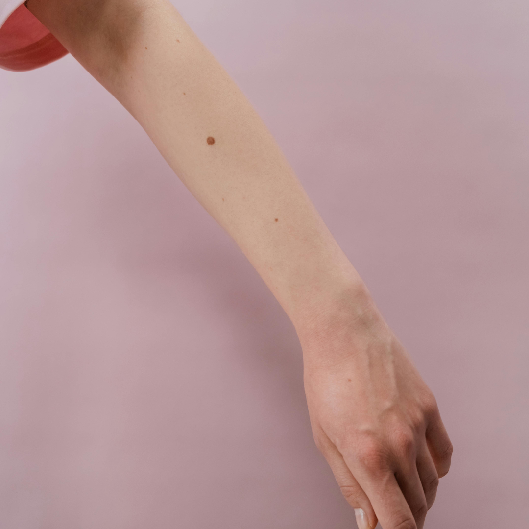 affordable mole removal inland empire